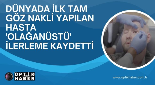 Dünyada ilk tam göz nakli yapılan hasta ‘olağanüstü’ ilerleme kaydetti…